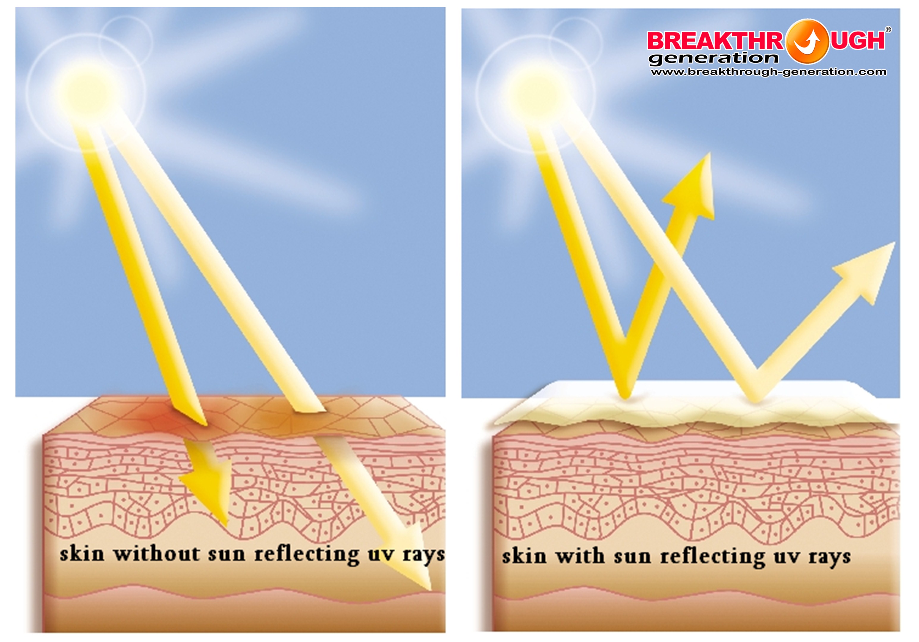 Влияние солнечных лучей на кожу человека